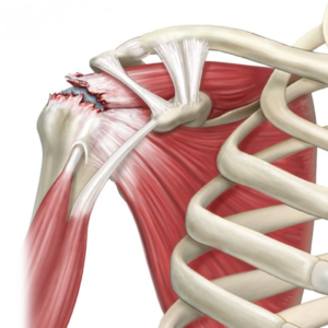 formation physio épaule